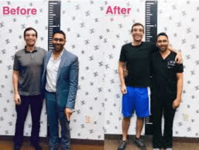 800万円で身長15センチアップ！アメリカの身長を伸ばす手術が予約殺到に